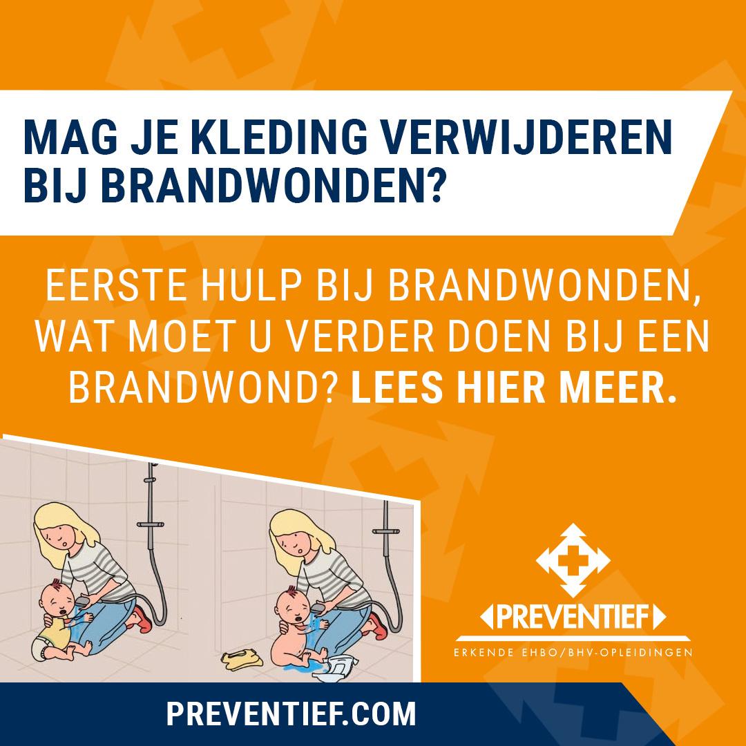Mag je kleding verwijderen bij brandwonden | Preventief BV